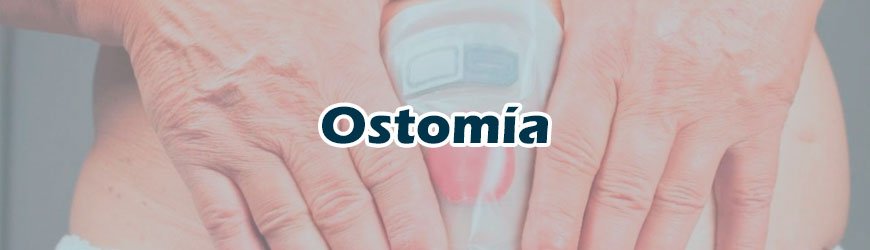 Ostomía